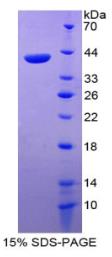 SDS-PAGE (CCL22-702H).jpg